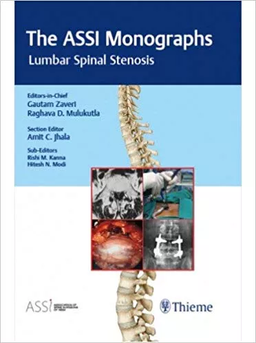 The ASSI Monographs: Lumbar Spinal Stenosis 1st Edition 2018 By Zaveri