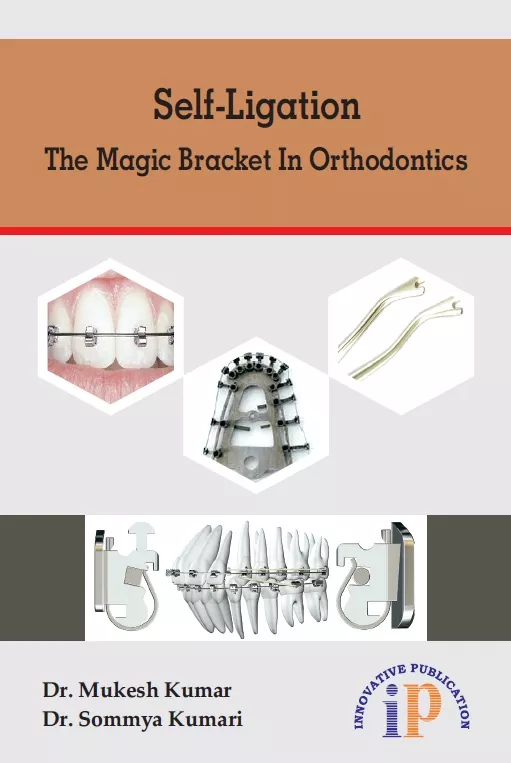 Self-Ligation - The Magic Bracket in Orthodontics, First Edition 2020, By Dr. Mukesh Kumar, Dr. Sommya Kumari